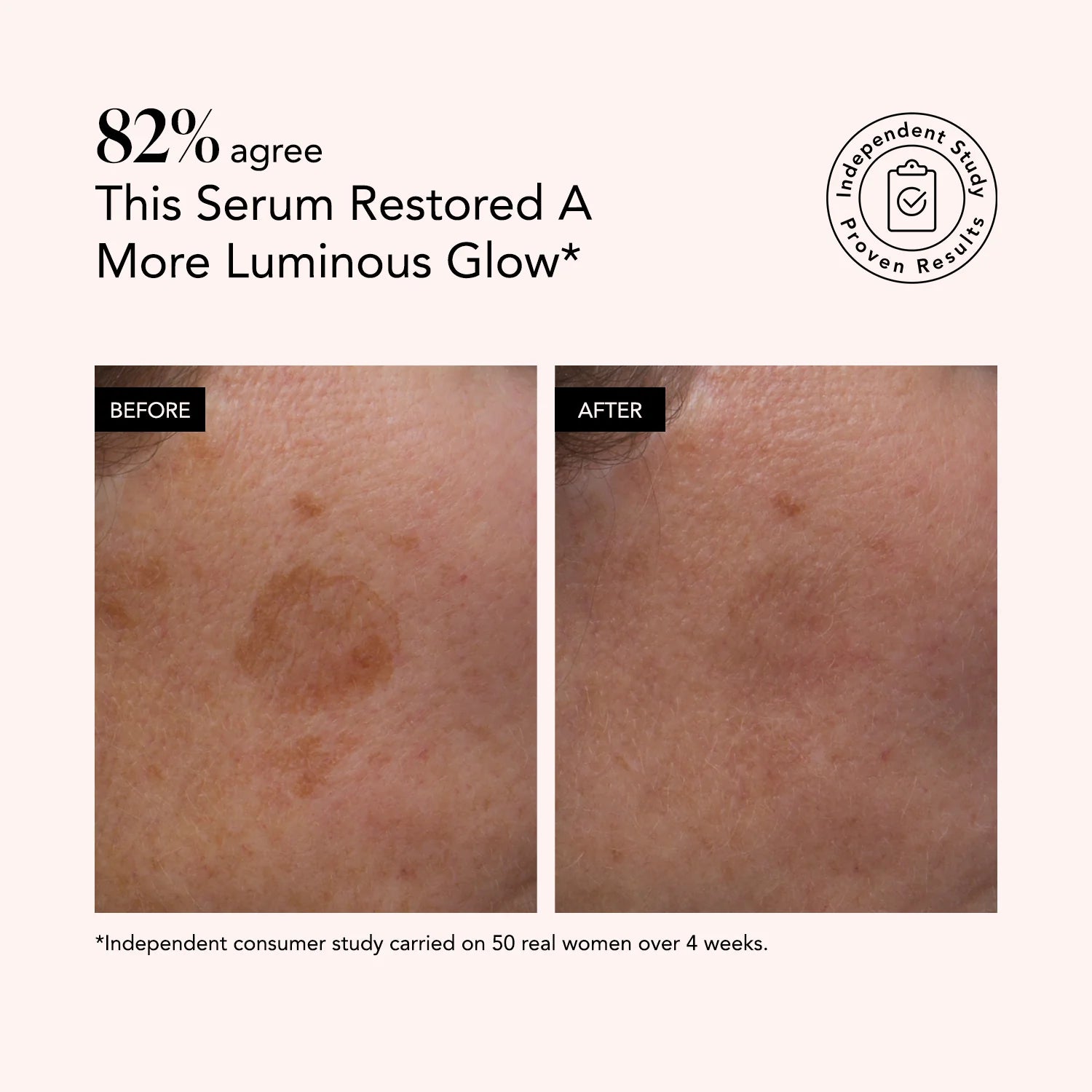 Odacité serum zbardhues me Vitaminë C & E + Acid Hialuronik 30ml