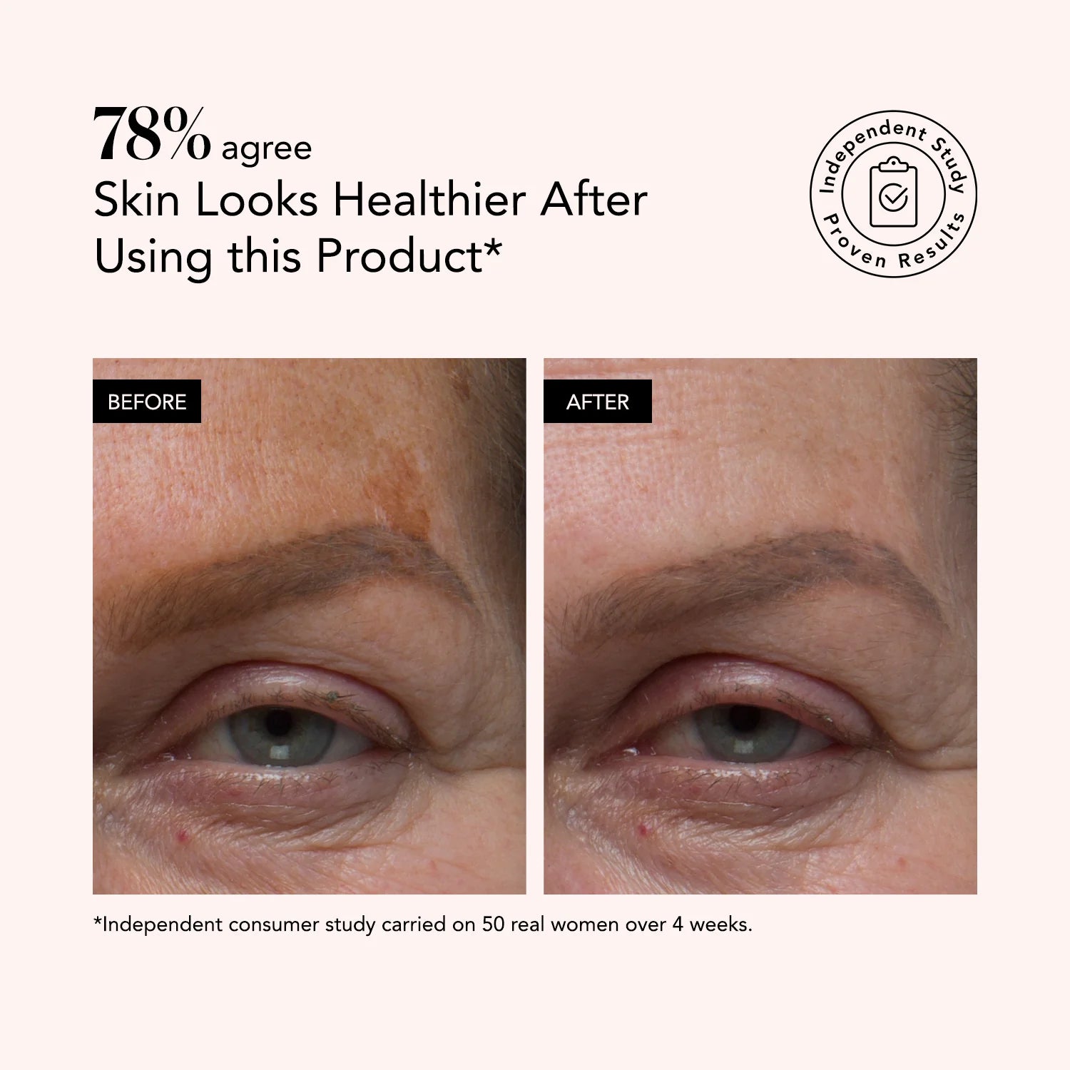 Odacité serum zbardhues me Vitaminë C & E + Acid Hialuronik 30ml